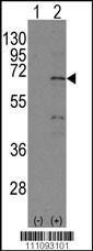 Anti-NR4A1 Rabbit Polyclonal Antibody (HRP (Horseradish Peroxidase))