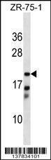 Anti-CBR4 Rabbit Polyclonal Antibody (FITC (Fluorescein Isothiocyanate))