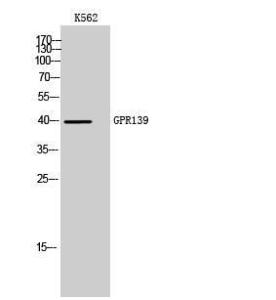 Anti-GPR 139 Rabbit Polyclonal Antibody