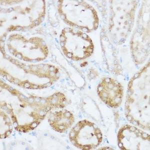 Immunohistochemistry analysis of paraffin-embedded rat kidney using Anti-NEURL1B Antibody (A305441) at a dilution of 1:100 (40x lens). Perform high pressure antigen retrieval with 10 mM citrate buffer pH 6.0 before commencing with IHC staining protocol.