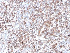 Antibody anti-PKC alpha 133 100 µg