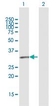 Anti-GPR146 Rabbit Polyclonal Antibody