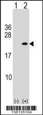 Anti-PLA2G12A Rabbit Polyclonal Antibody (FITC (Fluorescein Isothiocyanate))