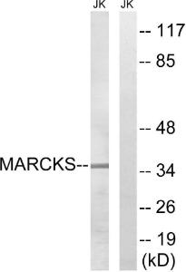 Western blot analysis of lysates from Jurkat cells using Anti-MARCKS Antibody. The right hand lane represents a negative control, where the antibody is blocked by the immunising peptide.