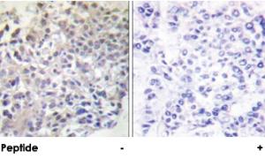 Anti-RAPGEF1 Rabbit Polyclonal Antibody