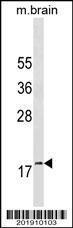 Anti-GABARAP Mouse Monoclonal Antibody (AP (Alkaline Phosphatase)) [clone: 424CT5.1.6]