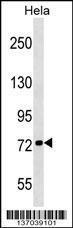 Anti-KIF3B Rabbit Polyclonal Antibody (AP (Alkaline Phosphatase))