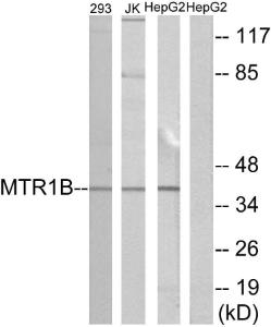 Western blot analysis of lysates from 293, Jurkat, and HepG2 cells using Anti-MTR1B Antibody. The right hand lane represents a negative control, where the antibody is blocked by the immunising peptide