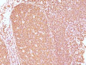 Immunohistochemical analysis of formalin-fixed, paraffin-embedded human tonsil using Anti-CD45RB Antibody [PD7/26]