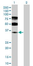 Anti-ENOPH1 Rabbit Polyclonal Antibody