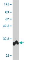 Anti-POLD4 Mouse Monoclonal Antibody [clone: 2C11]