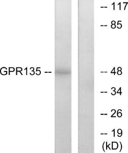 Western blot analysis of lysates from NIH/3T3 cells using Anti-GPR135 Antibody. The right hand lane represents a negative control, where the Antibody is blocked by the immunising peptide