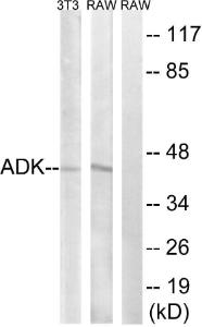 Western blot analysis of lysates from RAW264.7 and NIH/3T3 cells using Anti-ADK Antibody. The right hand lane represents a negative control, where the antibody is blocked by the immunising peptide.