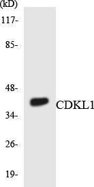 Anti-CDKL1 Rabbit Polyclonal Antibody