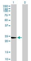 Anti-GSTM3 Mouse Polyclonal Antibody