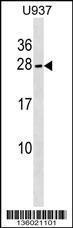 Anti-NKIRAS2 Rabbit Polyclonal Antibody (HRP (Horseradish Peroxidase))