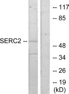 Western blot analysis of lysates from HeLa cells using Anti-SERC2 Antibody. The right hand lane represents a negative control, where the antibody is blocked by the immunising peptide