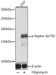 Western blot analysis of extracts of 293T cells, using Anti-Raptor (phospho Ser729) Antibody (A305442) at 1:1,000 dilution