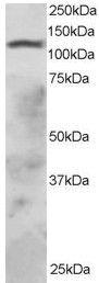 Anti-RNF31 Antibody (A83868) staining (2 µg/ml) of HepG2 lysate (RIPA buffer, 30µg total protein per lane). Primary incubated for 1 hour. Detected by chemilu minescence