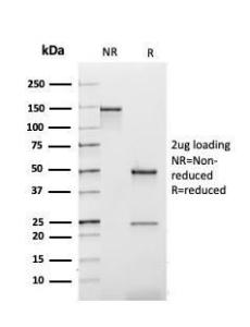 SDS-PAGE analysis of Anti-Kappa Light Chain Antibody [rL1C1] under non-reduced and reduced conditions; showing intact IgG and intact heavy and light chains, respectively SDS-PAGE analysis confirms the integrity and purity of the antibody