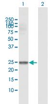 Anti-GSTM4 Rabbit Polyclonal Antibody