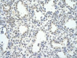 Anti-PPP1R8 Rabbit Polyclonal Antibody