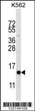 Anti-Histone H2B.c Rabbit Polyclonal Antibody (FITC (Fluorescein Isothiocyanate))