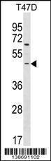 Anti-ARHGEF35 Rabbit Polyclonal Antibody (Biotin)