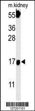 Anti-FGFBP3 Rabbit Polyclonal Antibody (AP (Alkaline Phosphatase))