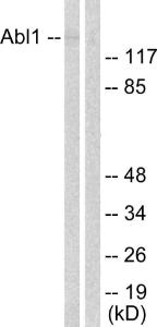 Western blot analysis of lysates from COS7 cells, treated with Adriamycin 0.5ug/ml 24h using Anti-Abl Antibody. The right hand lane represents a negative control, where the antibody is blocked by the immunising peptide