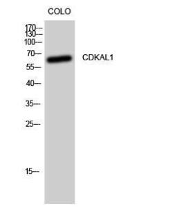 Western blot analysis of CoLo cells using Anti-CDKAL Antibody