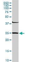 Anti-GSTM4 Rabbit Polyclonal Antibody