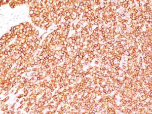 Immunohistochemical analysis of formalin-fixed, paraffin-embedded human tonsil using Anti-CD45RB Antibody [PD7/26]