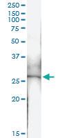 Anti-GSTM4 Rabbit Polyclonal Antibody