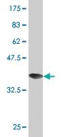 Anti-FAS Mouse Monoclonal Antibody [clone: 1D6]