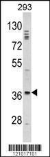 Anti-DLX2 Rabbit Polyclonal Antibody (AP (Alkaline Phosphatase))