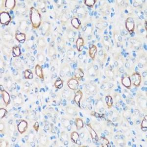 Immunohistochemistry analysis of paraffin-embedded mouse kidney using Anti-Aquaporin 2 Antibody (A305443) at a dilution of 1:100 (40x lens). Perform microwave antigen retrieval with 10 mM PBS buffer pH 7.2 before commencing with IHC staining protocol.