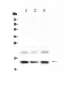 Anti-liver FABP Polyclonal Antibody