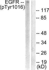 Western blot analysis of lysates from HUVEC cells treated with Serum 20% 30' using Anti-EGFR (phospho Tyr1016) Antibody. The right hand lane represents a negative control, where the antibody is blocked by the immunising peptide