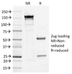 SDS-PAGE analysis of Anti-IL3RA Antibody [IL3RA/1531] under non-reduced and reduced conditions; showing intact IgG and intact heavy and light chains, respectively. SDS-PAGE analysis confirms the integrity and purity of the antibody.