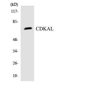 Western blot analysis of the lysates from HUVEC cells using Anti-CDKAL Antibody