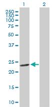 Anti-GSTM4 Rabbit Polyclonal Antibody