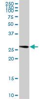 Anti-ENOPH1 Rabbit Polyclonal Antibody