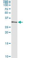 Anti-WARS2 Polyclonal Antibody Pair