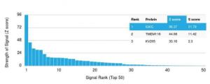 Analysis of protein array containing more than 19,000 full-length human proteins using Anti-Kappa Light Chain Antibody [rL1C1] Z-Score and S- Score