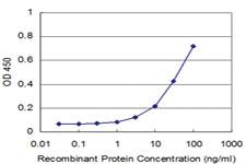 Anti-GHRL Mouse Monoclonal Antibody [clone: 4E8]