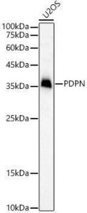 Western blot analysis of U2OS, using Anti-Podoplanin / gp36 Antibody (A305444) at 1:1,000 dilution. The secondary antibody was Goat Anti-Rabbit IgG H&L Antibody (HRP) at 1:10,000 dilution.