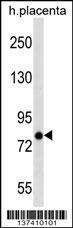 Anti-ARHGEF4 Rabbit Polyclonal Antibody (APC (Allophycocyanin))