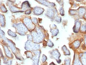 Immunohistochemical analysis of formalin-fixed, paraffin-embedded human placenta using Anti-HCG beta Antibody [SPM105]