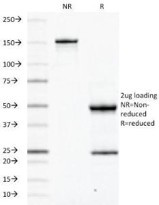 SDS-PAGE analysis of Anti-CD45RB Antibody [PD7/26] under non-reduced and reduced conditions; showing intact IgG and intact heavy and light chains, respectively. SDS-PAGE analysis confirms the integrity and purity of the antibody.